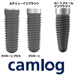 camlog カムログ