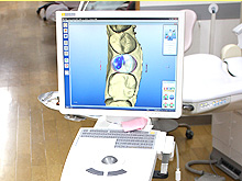 CAD/CAMによるセラミック装置